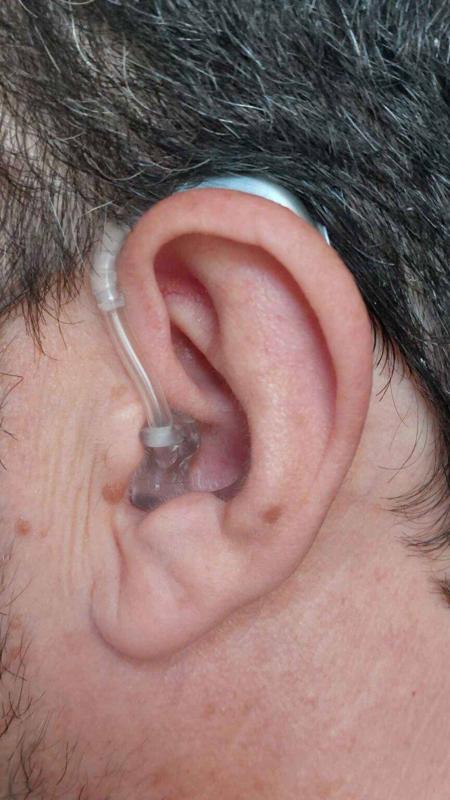 Acheter un appareil auditif contour d’oreille sur Marseille 3ème dans les Bouches-du-Rhône